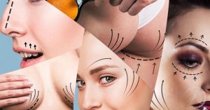 Por que as celebridades fazem tanta cirurgia plástica?