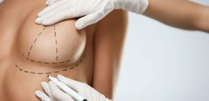 Por que as celebridades fazem tanta cirurgia plástica?